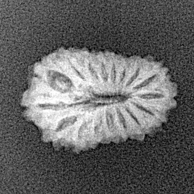 17 Mukhi Rudraksha 17.5mm 1.06gm - Xray