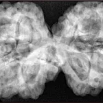11 MK Gaurishankar 40.3mm 10.41gm - Xray