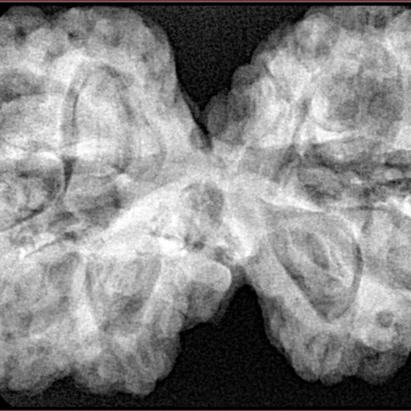 11 MK Gaurishankar 40.3mm 10.41gm - Xray