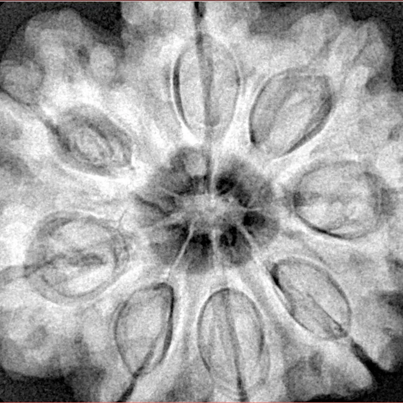 8 Mukhi Rudraksha 31.9mm 10.34gm - Xray