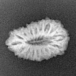 17 Mukhi Rudraksha 19.7mm 1.41gm - Xray