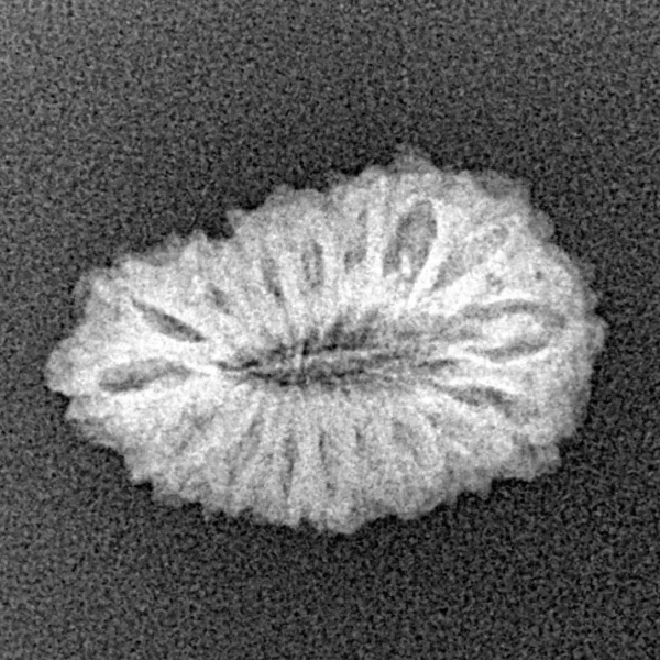 17 Mukhi Rudraksha 19.7mm 1.41gm - Xray