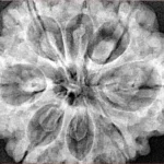 8 Mukhi Rudraksha 32.5mm 8.44gm - Xray