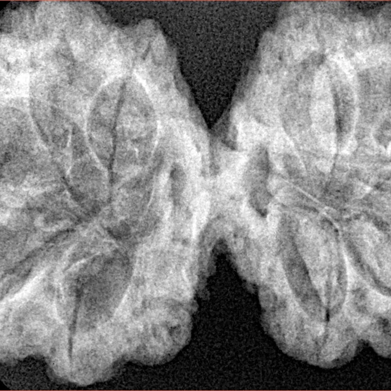 11 MK Gaurishankar 38.3mm 7.17gm - Xray