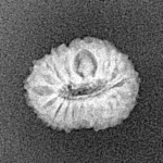 17 Mukhi Rudraksha 14.3mm 0.8gm - Xray