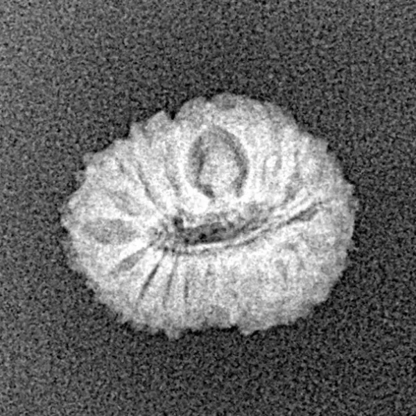 17 Mukhi Rudraksha 14.3mm 0.8gm - Xray