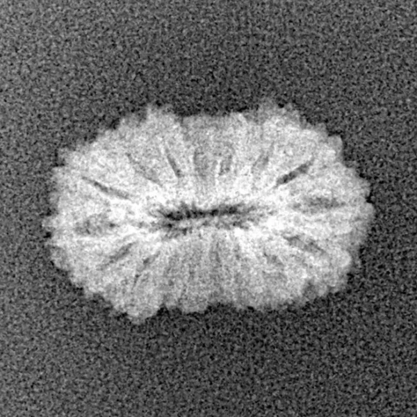 17 Mukhi Rudraksha 17.1mm 0.85gm - Xray