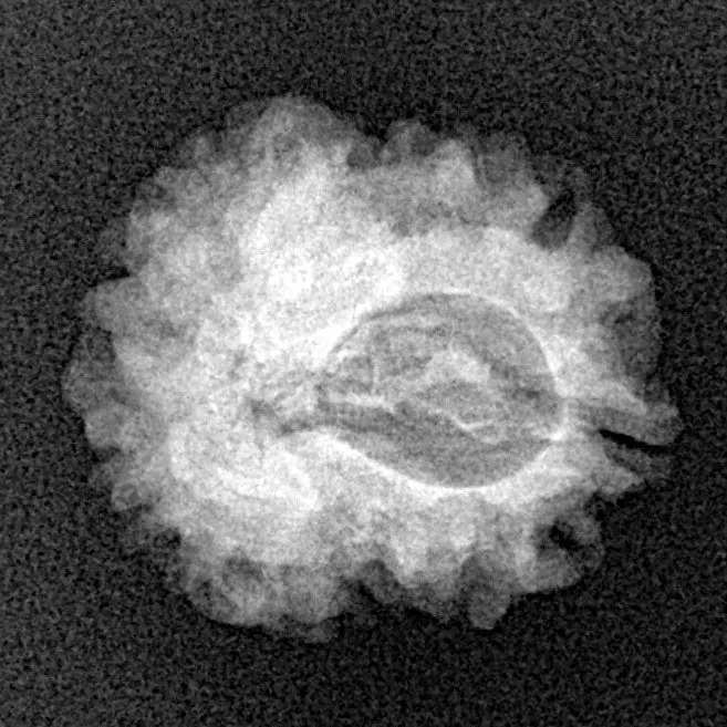 1 Mukhi Rudraksha 18.9mm 2.16gm - Xray