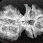 8 Mukhi G.S & Ganesh 31.6mm 5.21gm - Xray