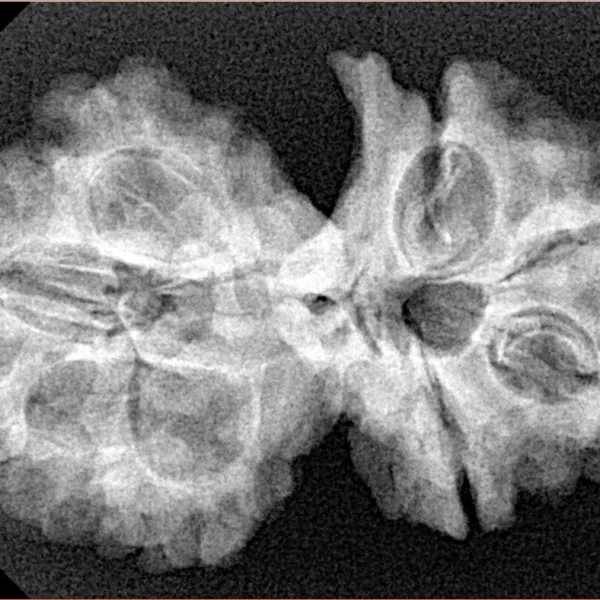 8 Mukhi G.S & Ganesh 31.6mm 5.21gm - Xray