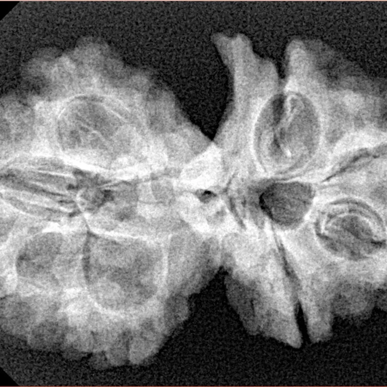 8 Mukhi G.S & Ganesh 31.6mm 5.21gm - Xray