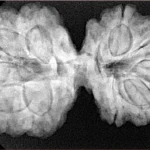 10 Mk Gaurishankar 37.8mm 8.35gm - Xray