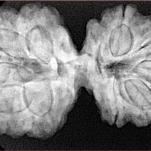 10 Mk Gaurishankar 37.8mm 8.35gm - Xray