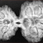 9 MK Gaurishankar 39.9mm 9.17gm - Xray