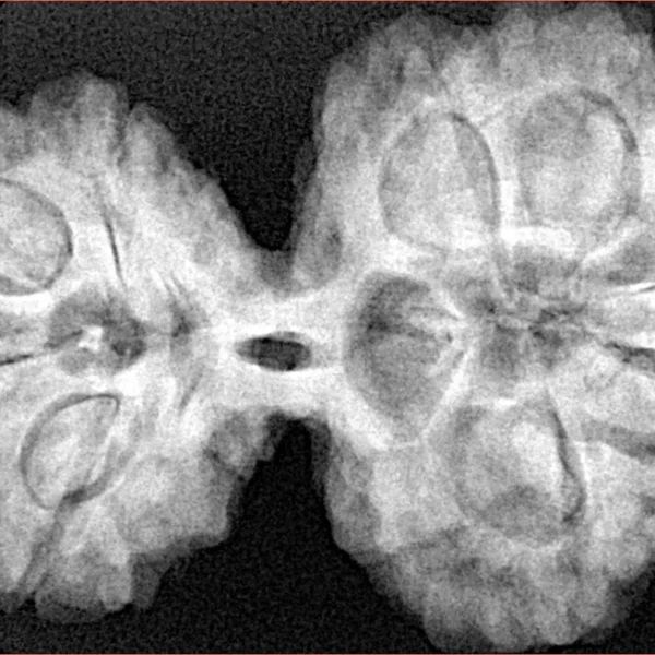 9 MK Gaurishankar 39.9mm 9.17gm - Xray