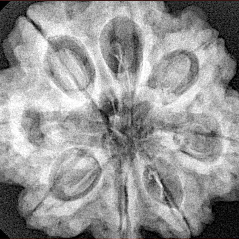 8 Mukhi Rudraksha 29.3mm 8.11gm - Xray