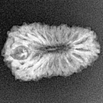18 Mukhi Rudraksha 22.4mm 1.62gm - Xray
