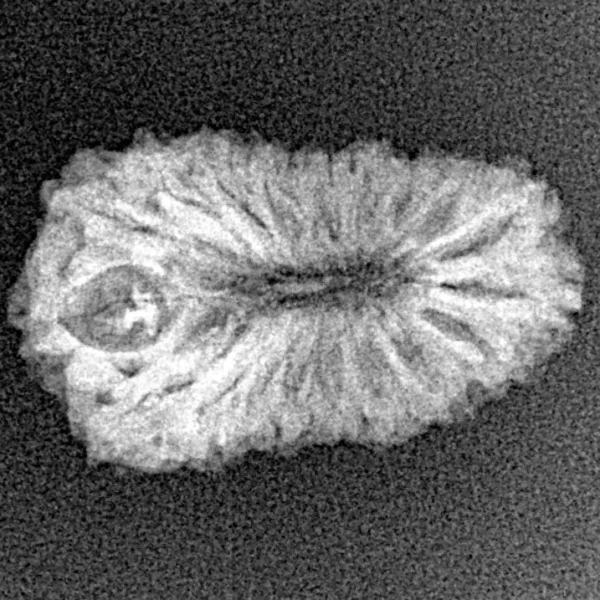 18 Mukhi Rudraksha 22.4mm 1.62gm - Xray