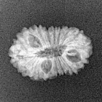 17 Mukhi Rudraksha 19.3mm 1.23gm - Origin: Indonesia - Xray