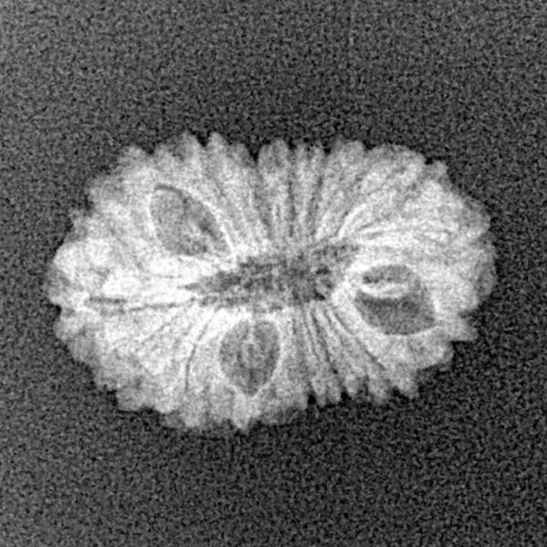 17 Mukhi Rudraksha 19.3mm 1.23gm - Origin: Indonesia - Xray