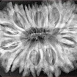 16 Mukhi Rudraksha 34.9mm 7.4gm - Xray