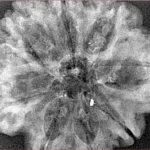 8 Mukhi Rudraksha 31.7mm 4.53gm - Xray
