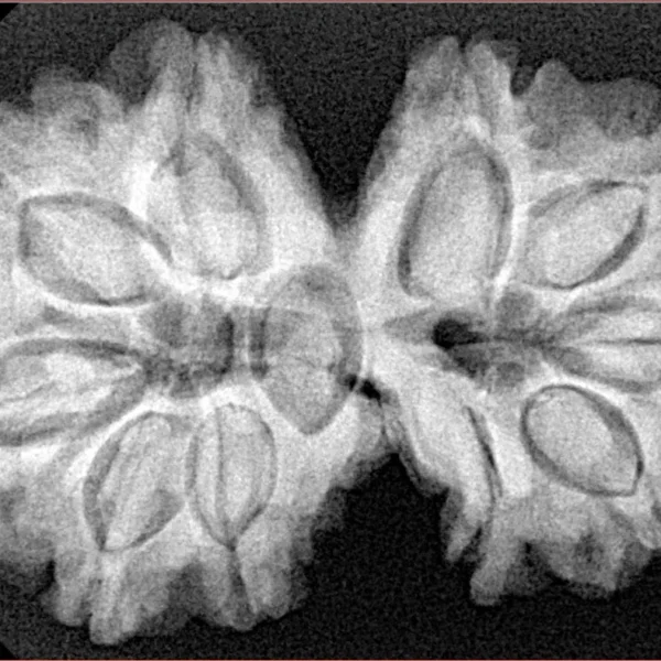 11 MK Gaurishankar 35.2mm 7gm - Xray