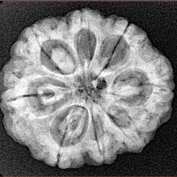 8 Mukhi Rudraksha 24.9mm 4.99gm - Xray
