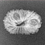 17 Mukhi Rudraksha 19.9mm 0.9gm - Xray