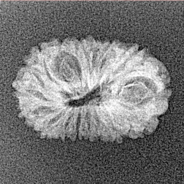 17 Mukhi Rudraksha 19.9mm 0.9gm - Xray