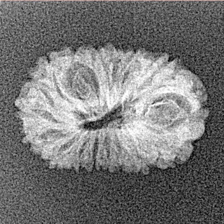 17 Mukhi Rudraksha 19.9mm 0.9gm - Xray