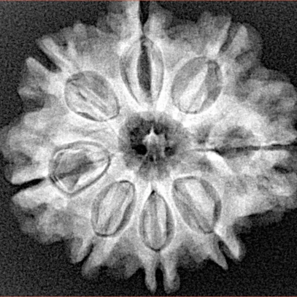 8 Mukhi Rudraksha 25.8mm 4.79gm - Xray