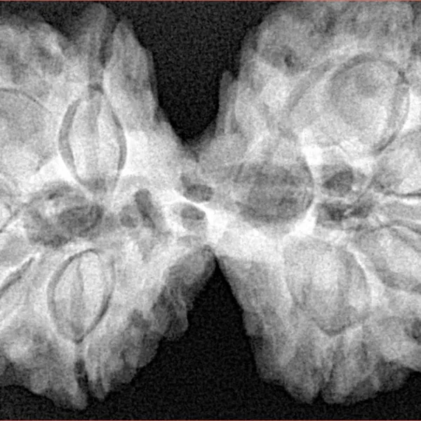 9 MK Gaurishankar 40.2mm 10.22gm - Xray