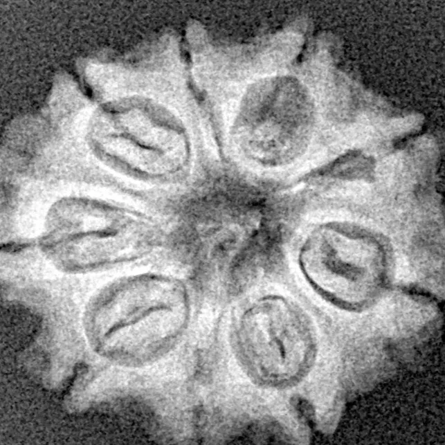 9 Mukhi Rudraksha 22.2mm 3gm - Xray