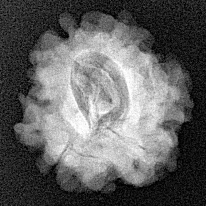 1 Mukhi Rudraksha 21mm 2.87gm - Xray