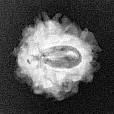 1 Mukhi Rudraksha 19.4mm 2gm - Xray