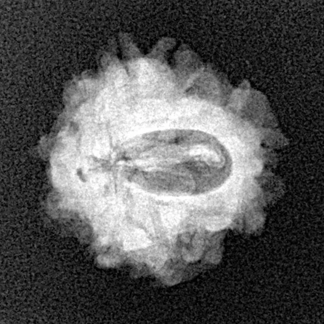 1 Mukhi Rudraksha 19.4mm 2gm - Xray