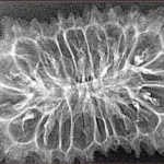 20 Mukhi Rudraksha 37.9mm 3.85gm - Xray