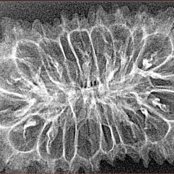 20 Mukhi Rudraksha 37.9mm 3.85gm - Xray