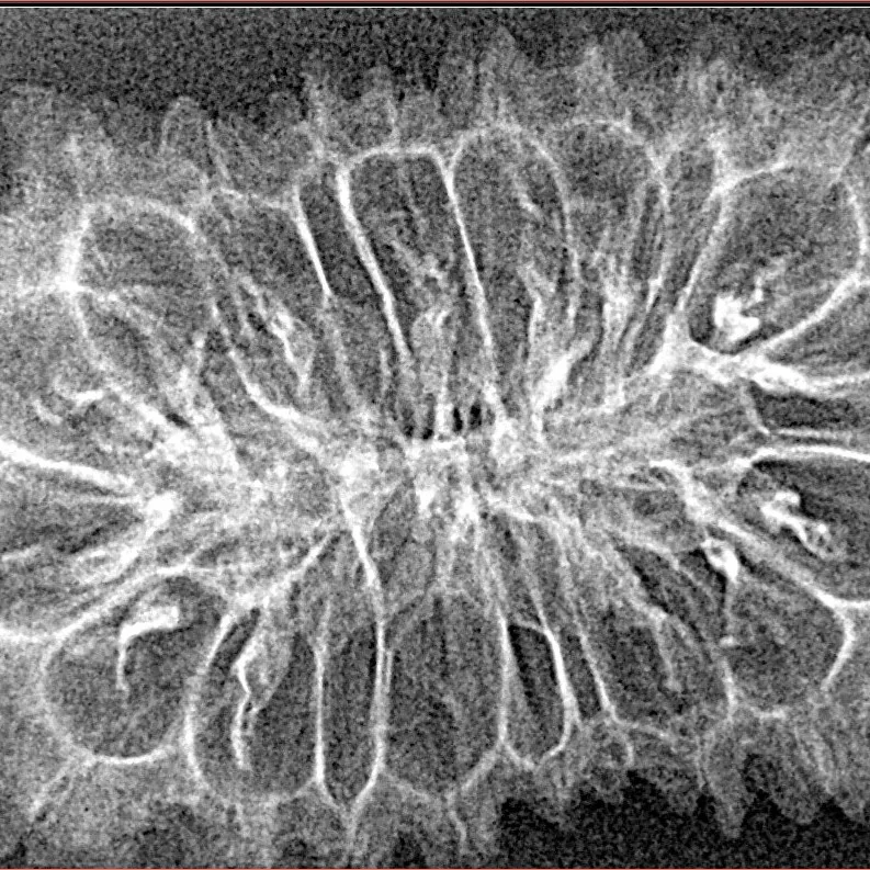 20 Mukhi Rudraksha 37.9mm 3.85gm - Xray
