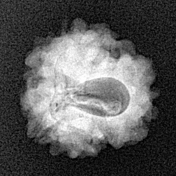 1 Mukhi Rudraksha 18.6mm 1.91gm - Xray