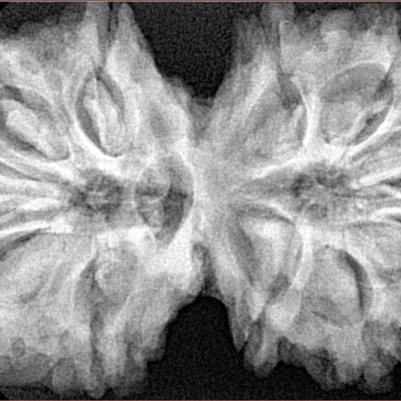 11 MK Gaurishankar 39.9mm 9.39gm - Xray