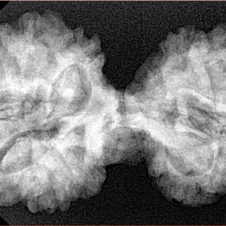 12 MK Gaurishankar 37.8mm 7.21gm - Xray