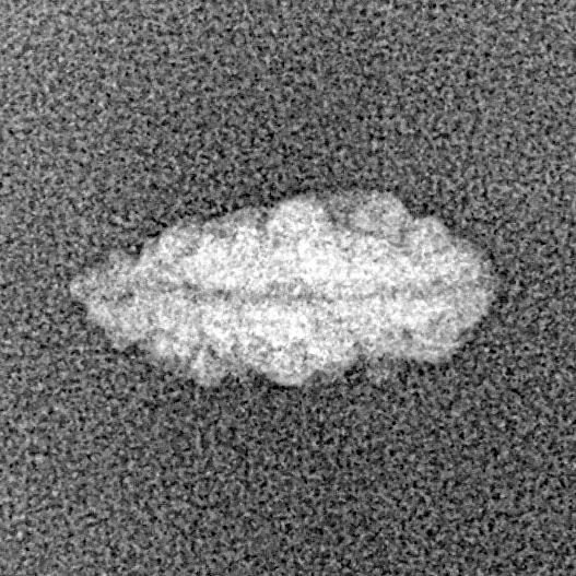 1 Mukhi Rudraksha 12.9mm 0.19gm - Xray