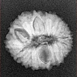 16 Mukhi Rudraksha 19mm 2gm - Xray