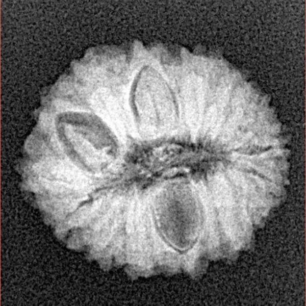 16 Mukhi Rudraksha 19mm 2gm - Xray
