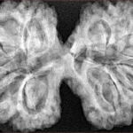 10 Mk Gaurishankar 40.4mm 8.99gm - Xray