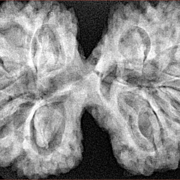 10 Mk Gaurishankar 40.4mm 8.99gm - Xray