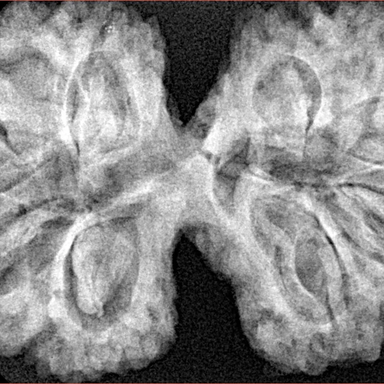 10 Mk Gaurishankar 40.4mm 8.99gm - Xray