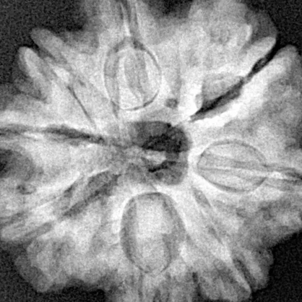 8 Mukhi Rudraksha 26.8mm 6.61gm - Xray